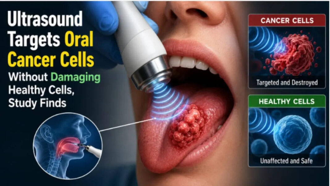 Ultrasound Targets Oral Cancer Cells Without Damaging Healthy Cells, Study Finds