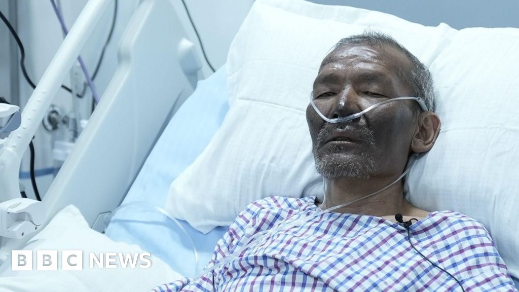 An Everest guide's miraculous survival raises questions for tourism industry